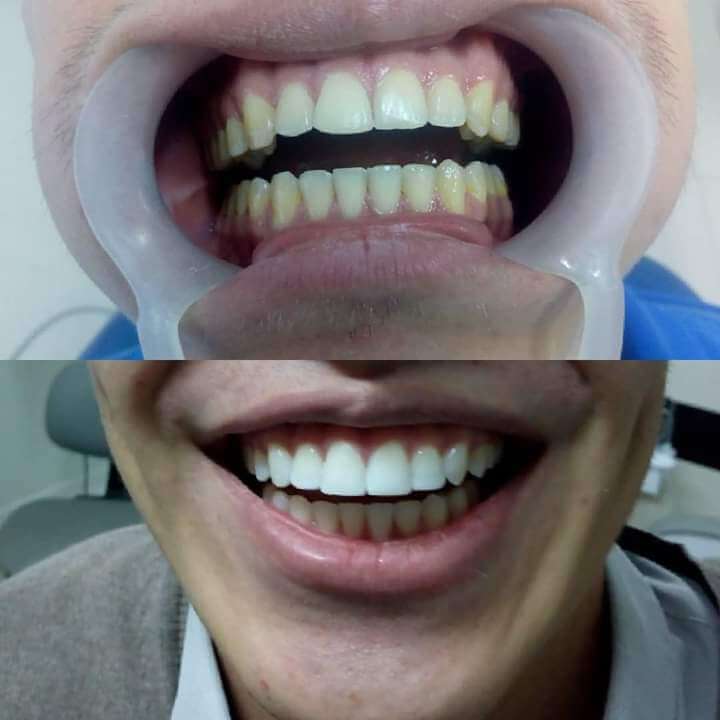 Card image description