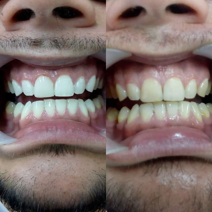 Card image description