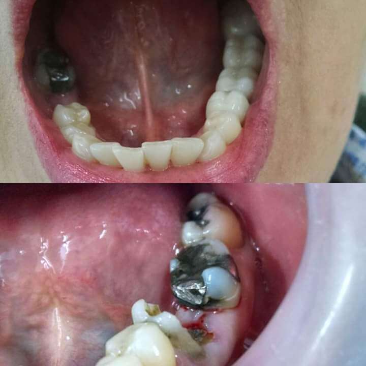 Card image description