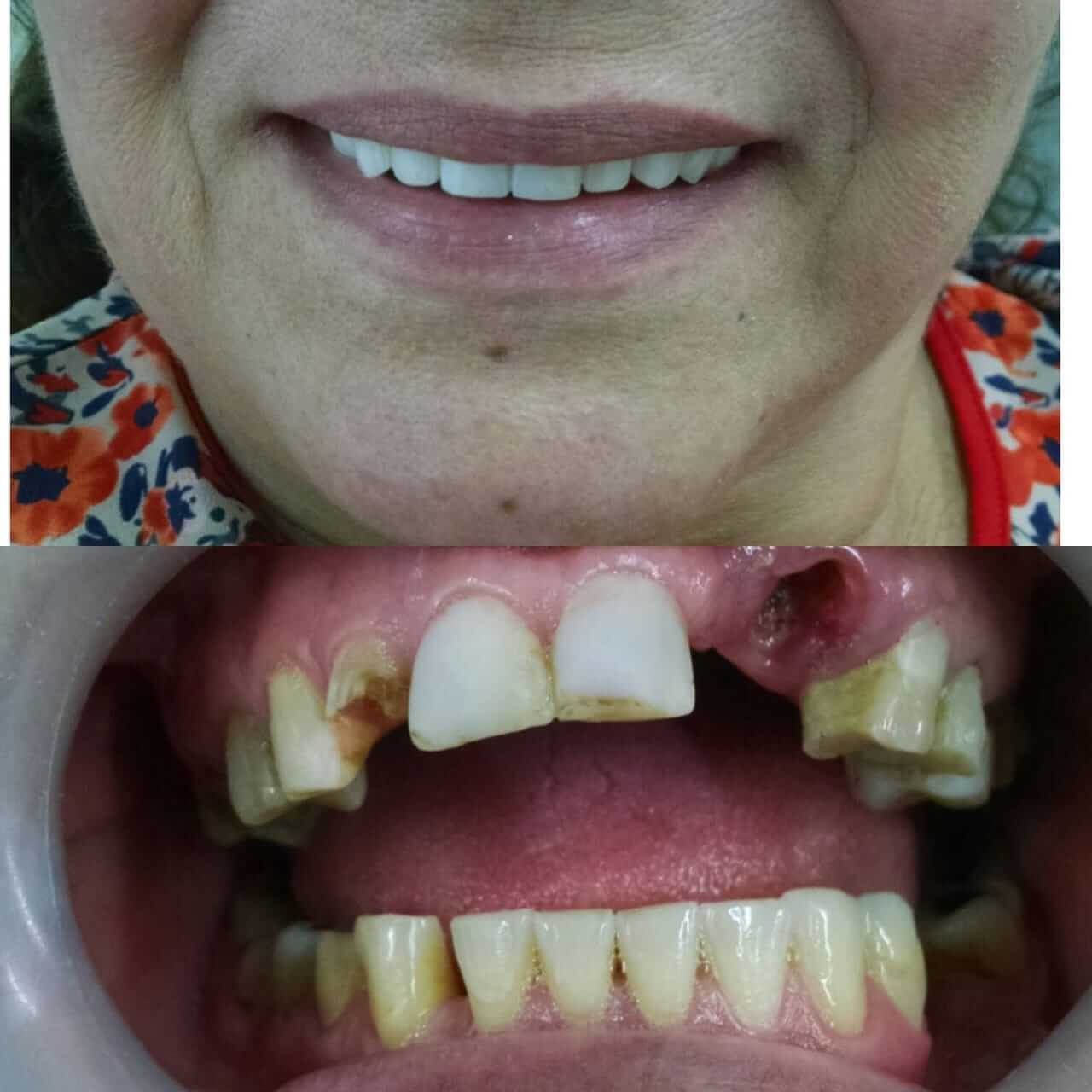 Card image description