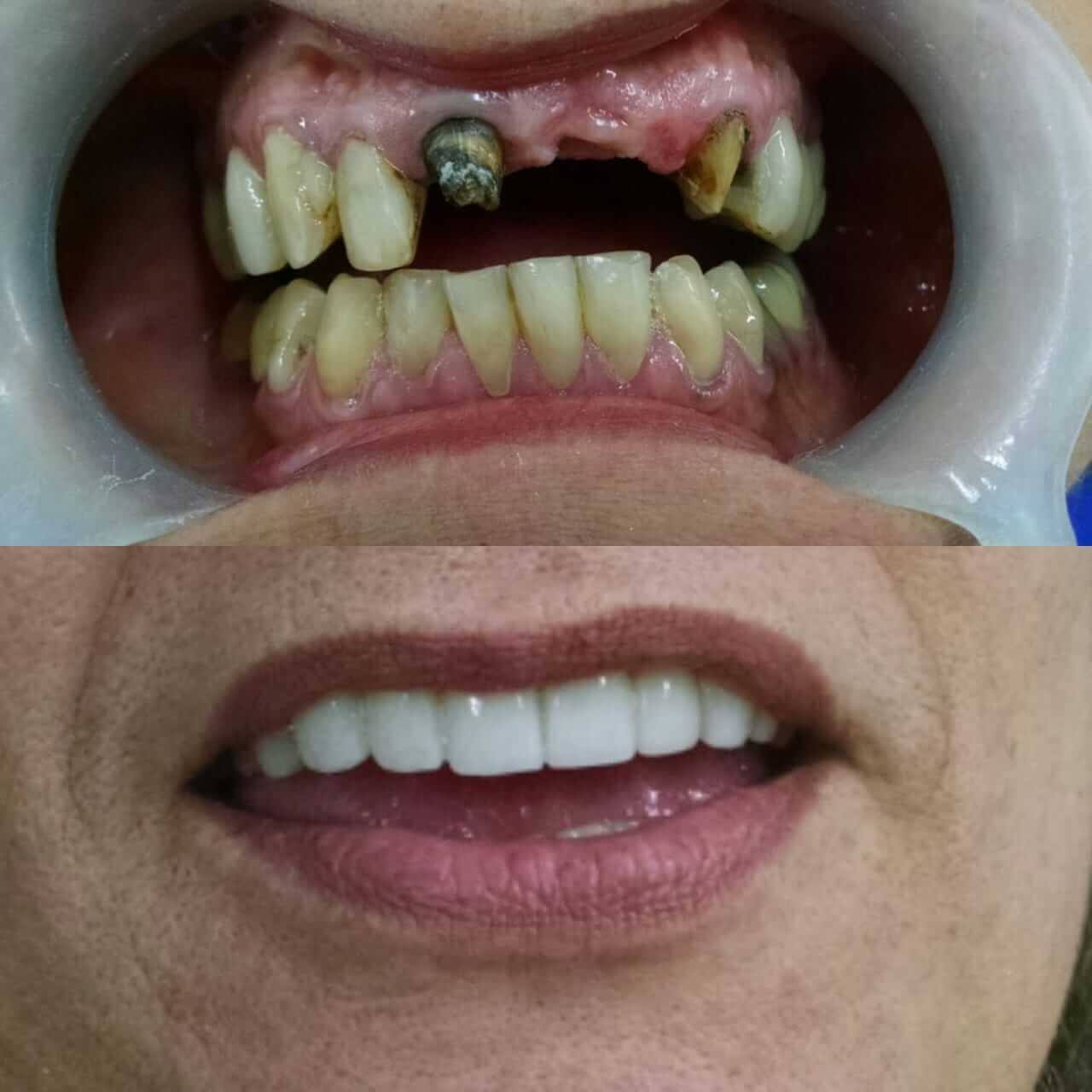 Card image description